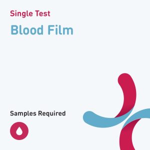 5802 blood film