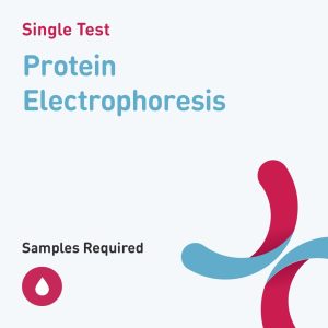 5848 protein electrophoresis