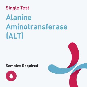 6168 alanine aminotransferase alt