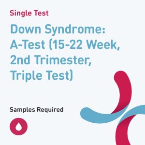 6557 down syndrome a test 15 22 week 2nd trimester triple test
