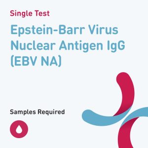 6563 epstein barr virus nuclear antigen igg ebv na
