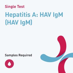 6578 hepatitis a hav igm hav igm