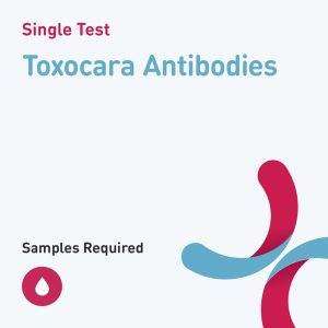 6629 toxocara antibodies