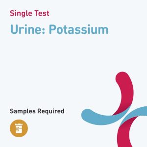 6637 urine potassium