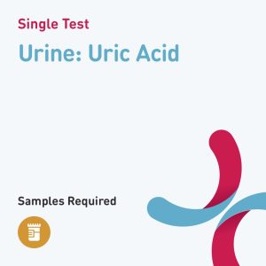 6639 urine uric acid