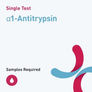 6648 a1 antitrypsin