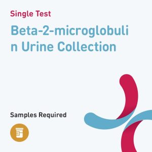 83801 beta 2 microglobulin urine collection
