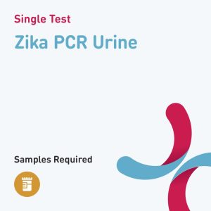 83850 zika pcr urine